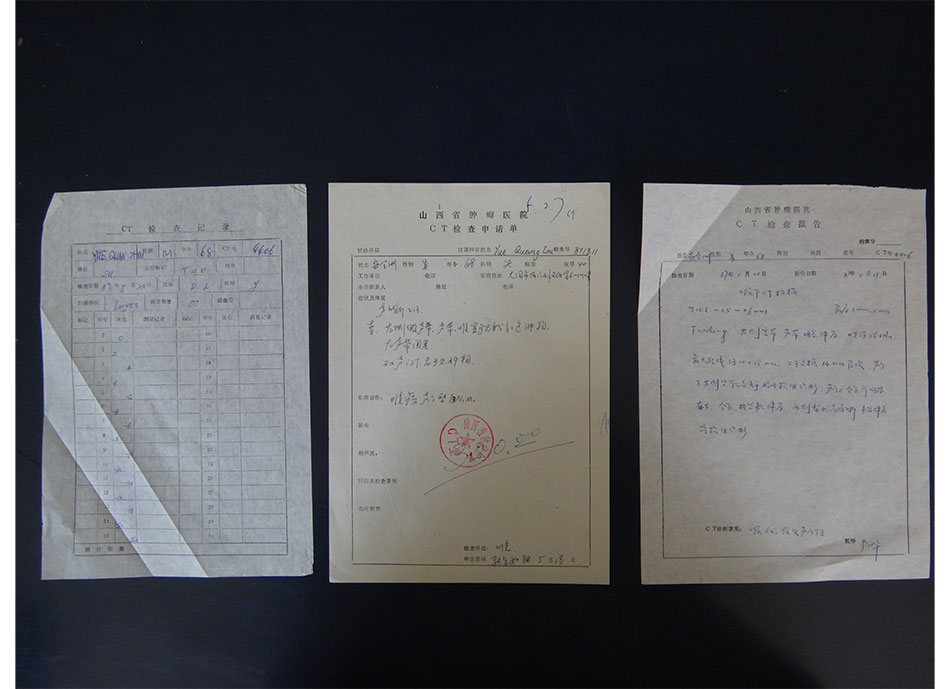 1987年CT申请单、扫描记录单，报告单
